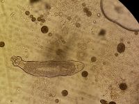 Mixed parasite infection in fry.